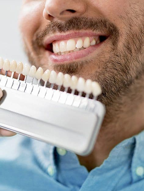 A smiling man holding a tooth shade guide next to his teeth