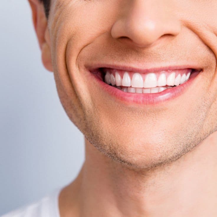 Close-up of a bright, even smile