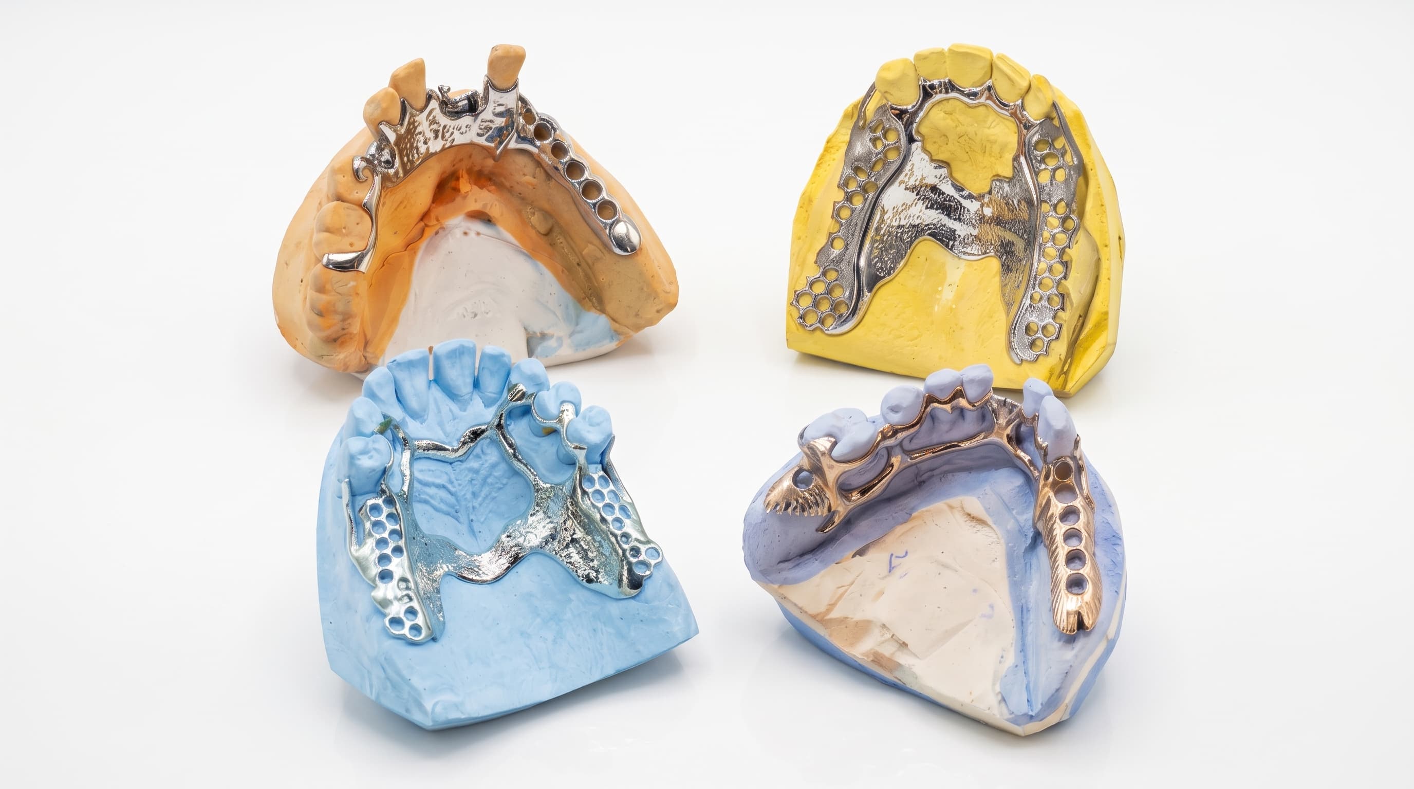 Four cast metal framework dentures on stone models