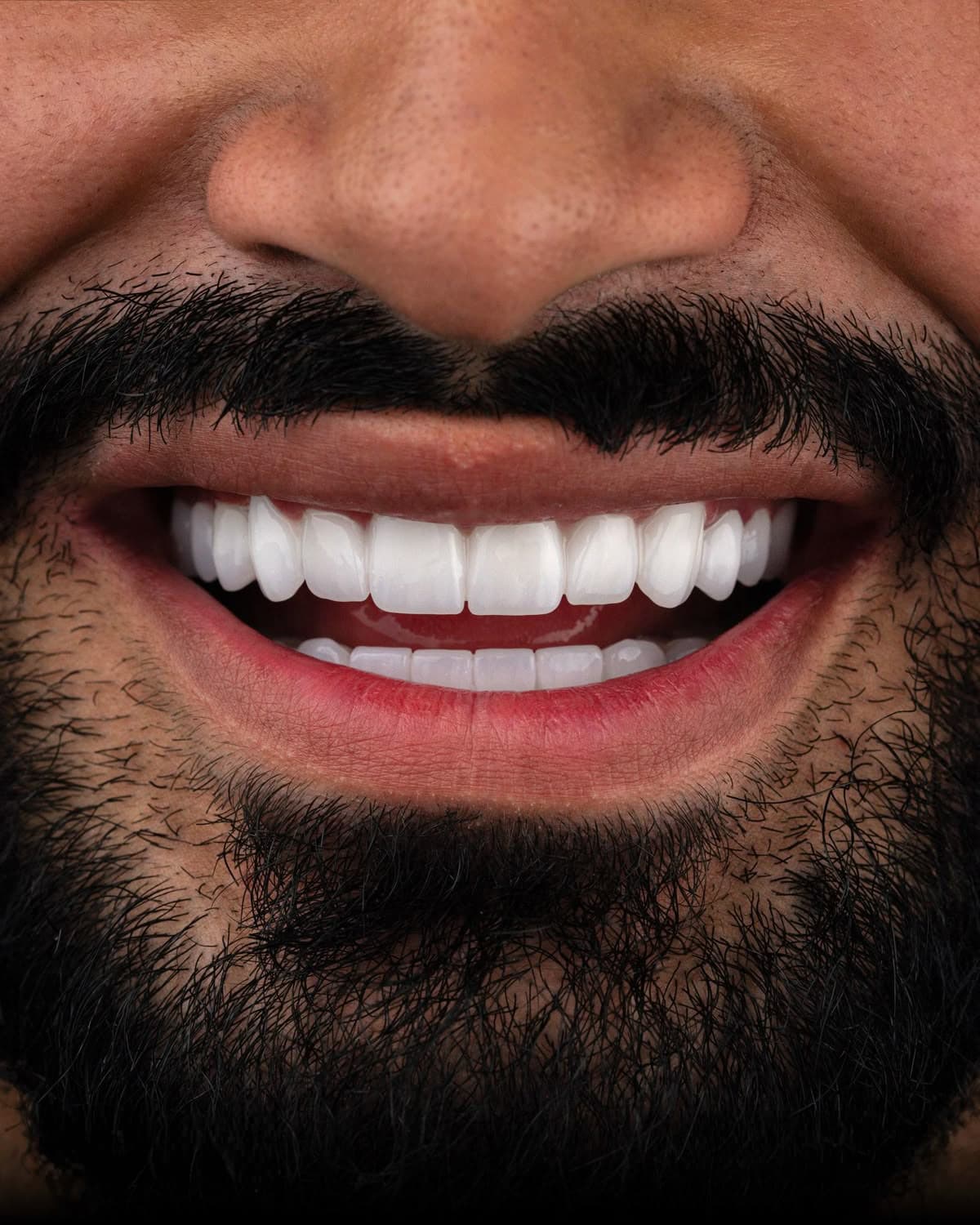 Close-up of a bearded man's wide, white smile