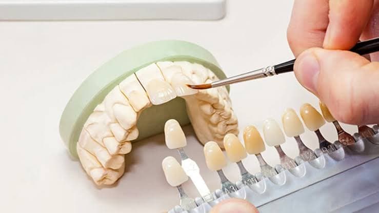 Ceramic teeth being painted next to a shade guide